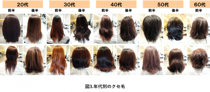 クセ毛の原因 まっすぐきれいに生えないのはなぜ ヘアコラム Laboratory Lebel ルベル オフィシャルサイト クセ毛の原因 まっすぐきれいに生えないのはなぜ ヘアコラム Laboratory Lebel ルベル オフィシャルサイト