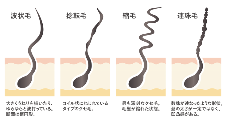 クセ毛の原因 まっすぐきれいに生えないのはなぜ ヘアコラム Laboratory Lebel ルベル オフィシャルサイト