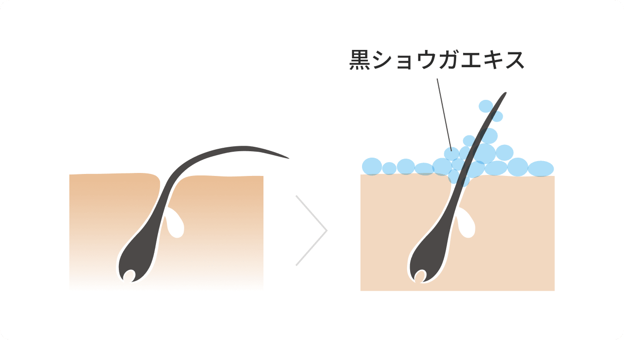 黒ショウガエキス